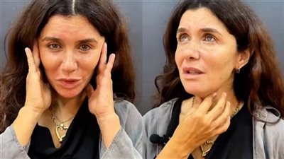 بعد توثيق رحلة خضوعها لعملية تجميل.. غادة عادل تتصدر التريند
