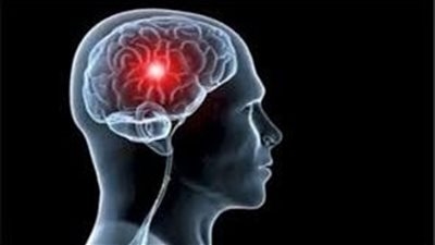 منتج شائع في المنازل قد يسبب سكتة دماغية.. ما هو المحلول الذي نحذر منه؟
