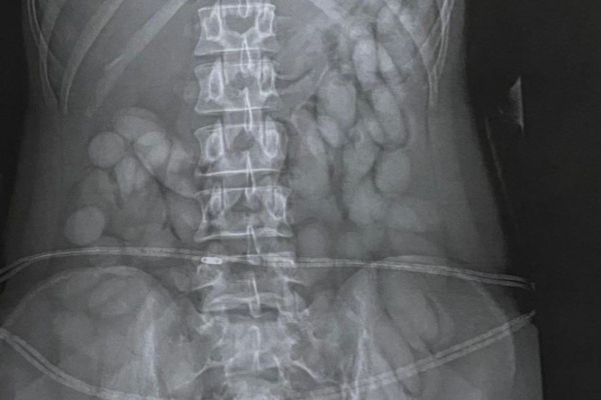 SAPS warns young women of perils of drug trafficking