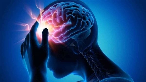 4 أعراض للسكتة الدماغية و6 طرق للوقاية منها