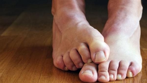 كيفية التخلص من متلازمة تململ الساقين في المنزل