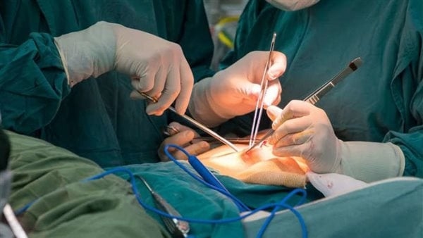 وزنه 12 كيلو، مستشفي المطرية ينجح في استئصال ورم ضخم لسيدة 40 عاما