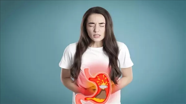 أعراض ارتجاع المريء وأسباب حدوثه