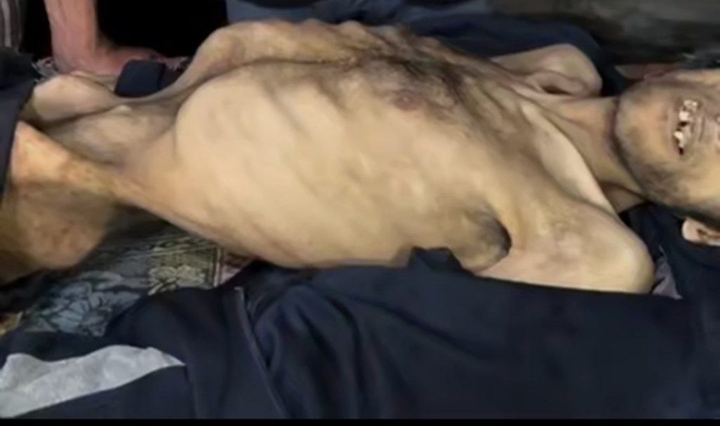 حملة تغريدات كبرى تنطلق لكشف جريمة الحصار والتجويع في غزة
